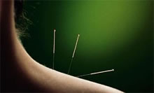Is Acupuncture Really a Luxury?